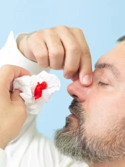 
Репозиция (восстановление) костей носа