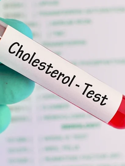 Анализ крови на Холестерин ЛПВП, ЛПНП (Липопротеиды высокой, низкой плотности )