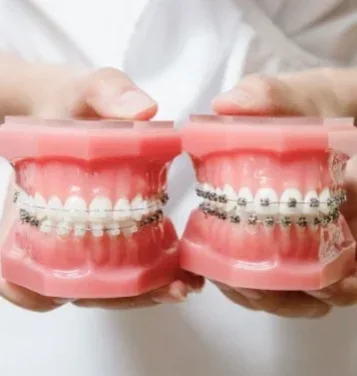 Консультация стоматолога - ортодонта