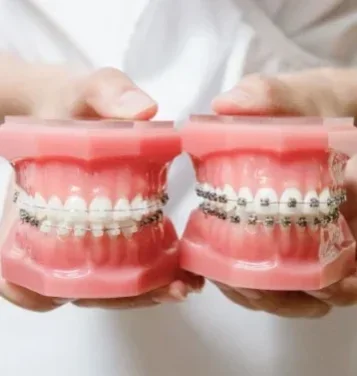 Фото для Консультация стоматолога - ортодонта
