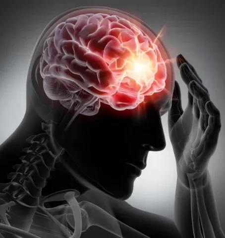 МРТ головного мозга при эпилепсии (эпирежиме)