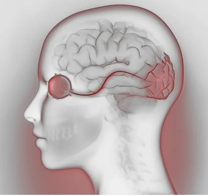 МРТ головного мозга + орбиты - развернутое исследование
