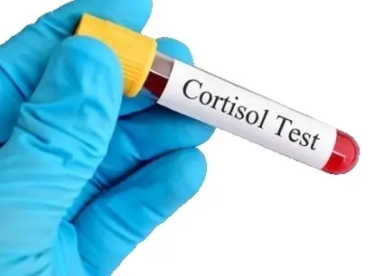 Исследование общего кортизола в крови ИФА методом