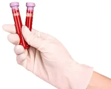 Фото для Анализ крови на хлориды