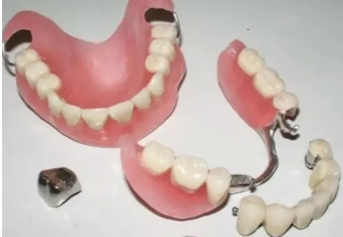 Протезирование зубов в Благовещенске
