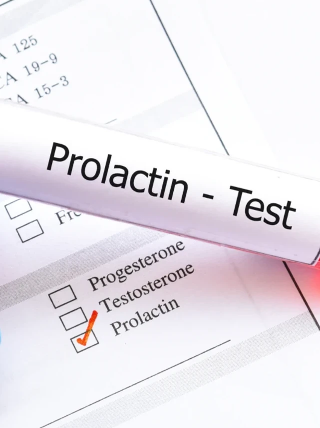 Анализ крови на пролактин методом ИФА. Анализ на пролактин с определением макропролактина